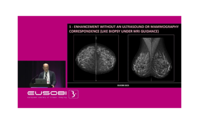 EUSOBI 2023 Symposium: CEM Guided Biopsy in prone position by Enrico Cassano